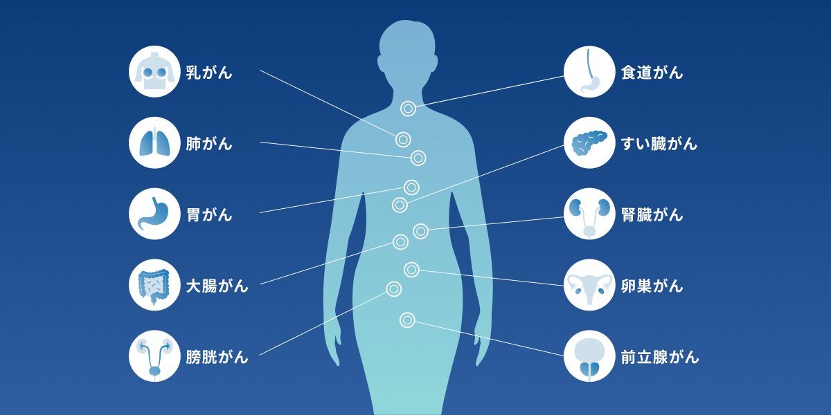 尿がん検査マイシグナル® 10がん種人体図