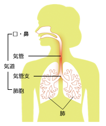 気管支ぜんそく